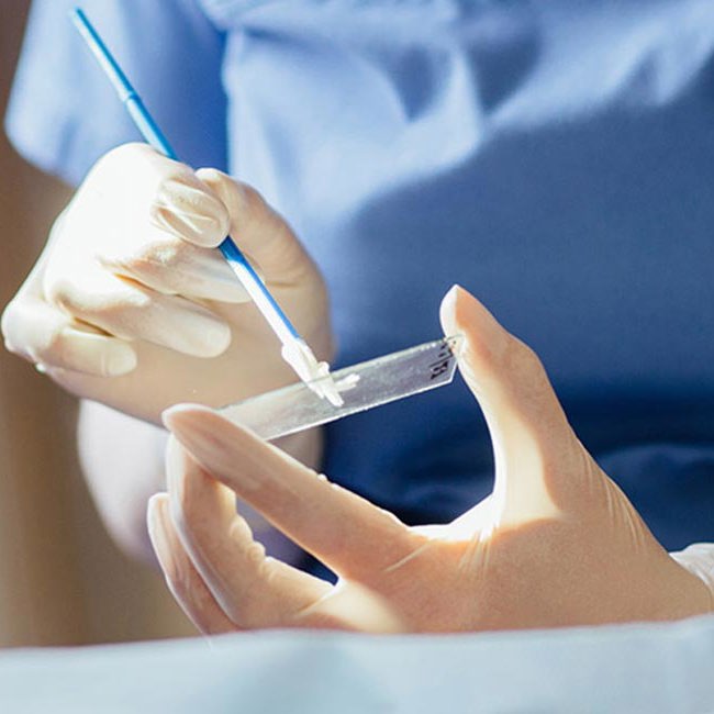 Læge analysere en prøve.