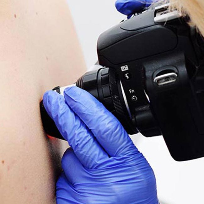 Læge udfører hudanalyse på patient.