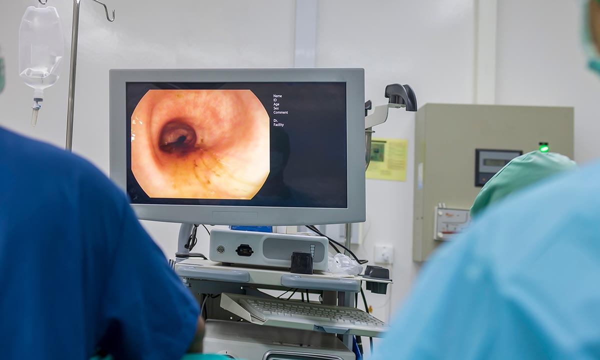 Læge analyserer en kikkertundersøgelse af tyktarmen.