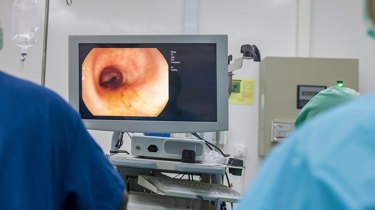 Læge analyserer en kikkertundersøgelse af tyktarmen.