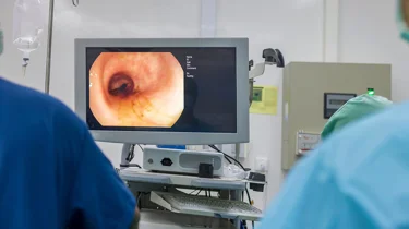 Læge analyserer en kikkertundersøgelse af tyktarmen.