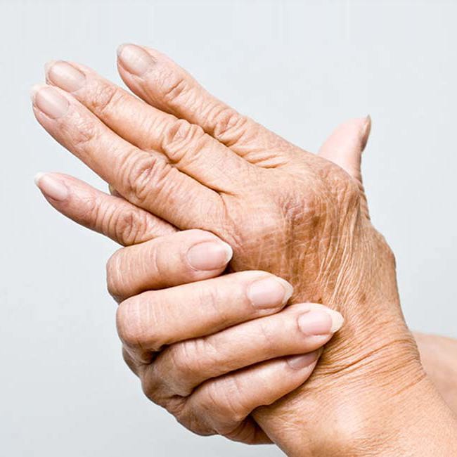 Ældre kvinde strækker sine hænder grundet håndsmerter.