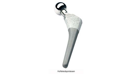 En hofteprotese.