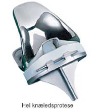 En hel knæledsprotese.