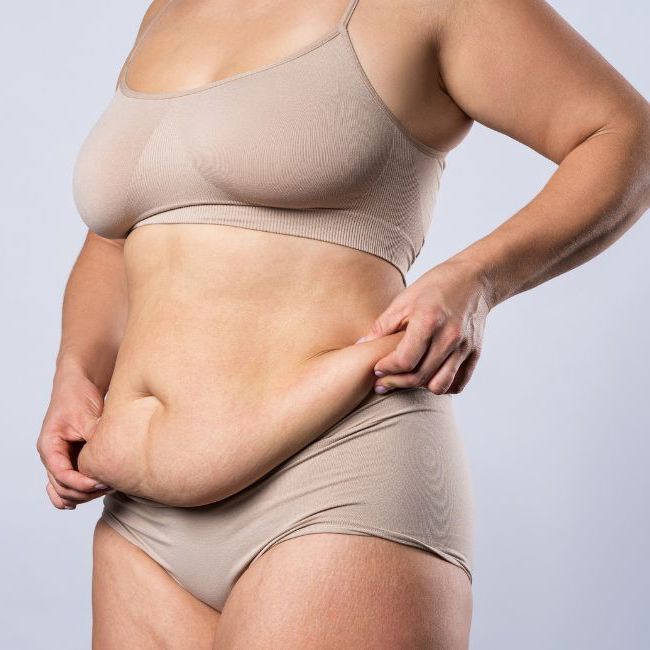 Kvinde holder ud i sin løse hud på maven efter stort vægttab.