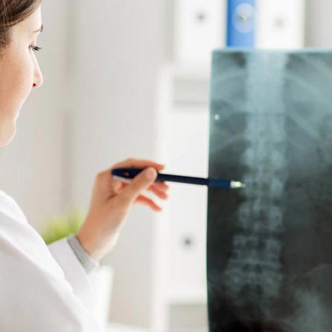 En læge sidder på et af Aleris hospitaler og kigger på et røntgenbillede af en rygsøjle.