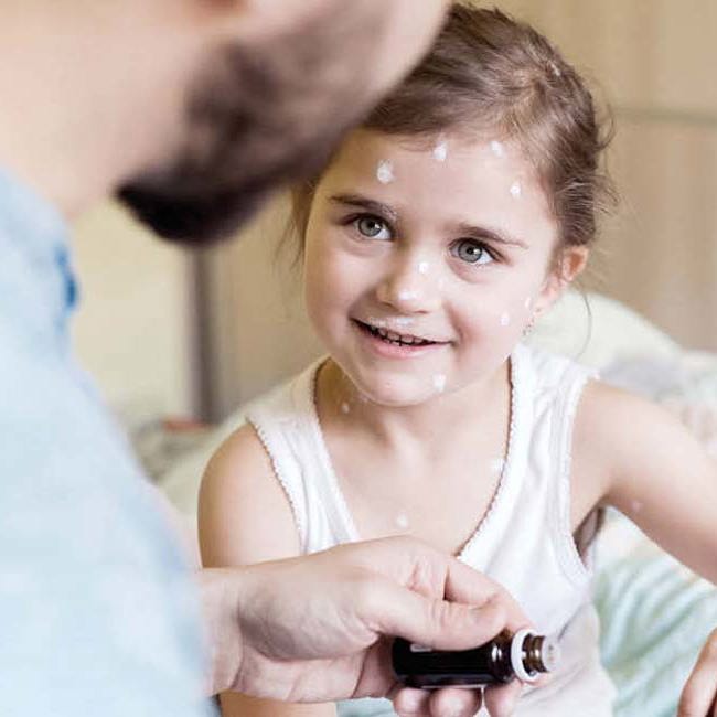 Et barn syg med skoldkopper.